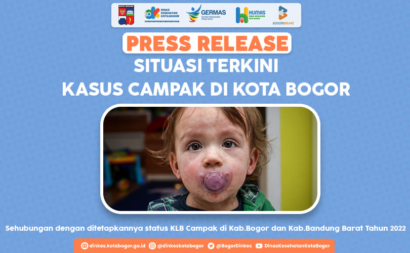 PRESS RELEASE SITUASI TERKINI KASUS CAMPAK DI KOTA BOGOR